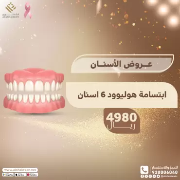 ابتسامة هوليوود 6 اسنان